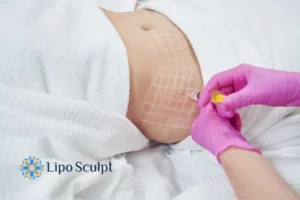 Are The Results From Aqualyx Permanent? 1 Do you want to know how long Aqualyx Bognor Regis results last?